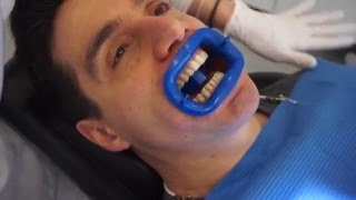 blanqueante dental,Philips Zoom paso a paso