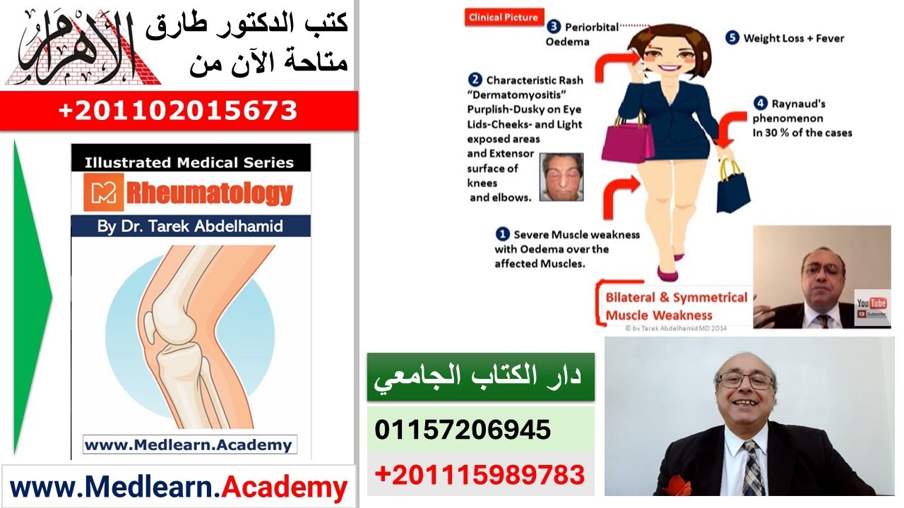 Polymyositis   #cme #internal_medicine  #usmle #medicalschool   #medical #محاضرات_باطنة