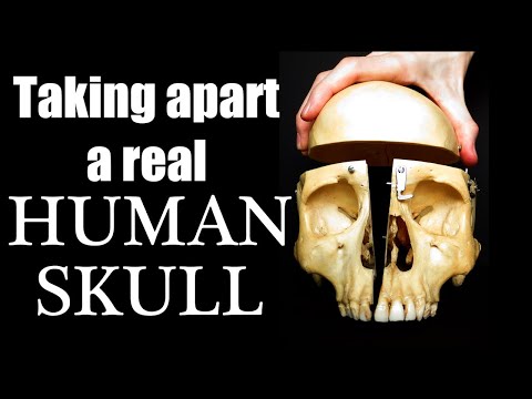 Look inside a REAL Human Skull