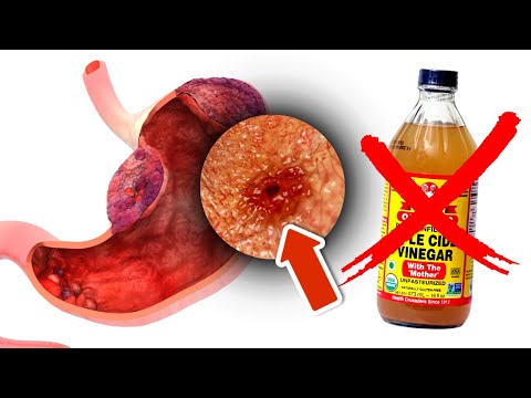 Don't Take Apple Cider Vinegar If You Have Any Of These Conditions