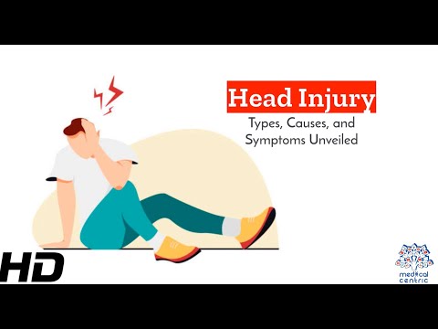 Head Injuries Unraveled: Types, Causes, and Symptoms Explored