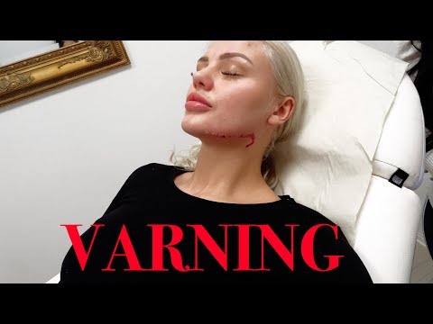 Julia möblerar om ansiktet (känsliga tittare varnas)