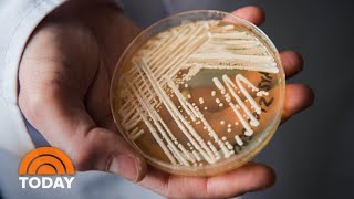 Deadly Super Fungus Spreading Across US: How To Avoid It | TODAY