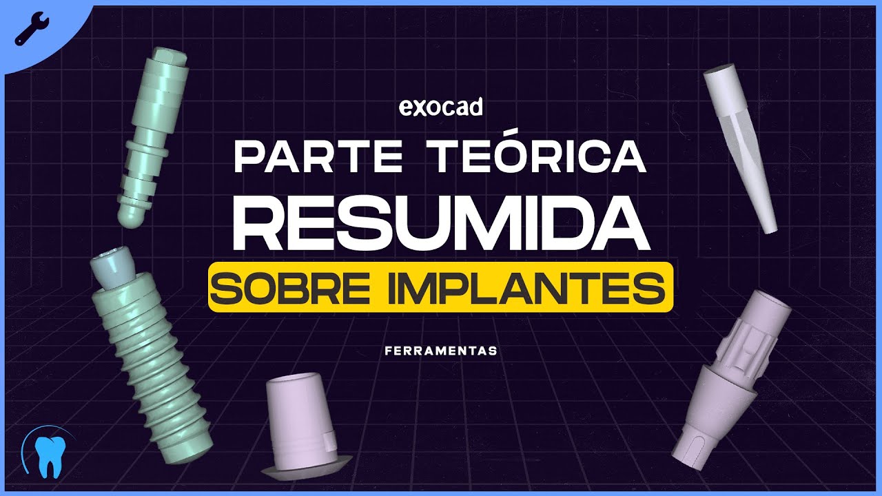 EXOCAD : Parte teórica resumida sobre IMPLANTES