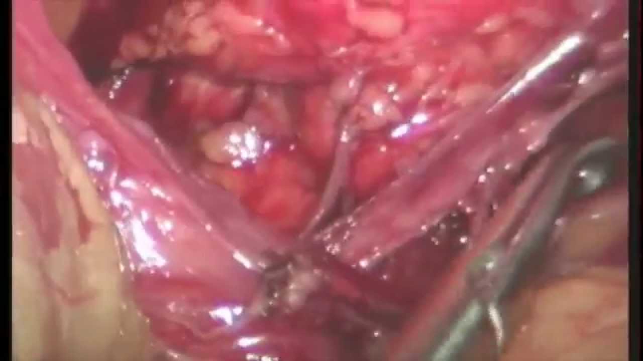 Luis V Ponce Pérez-21