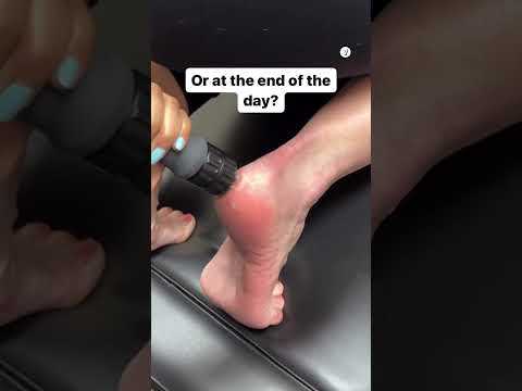 How to fix plantar fasciitis!