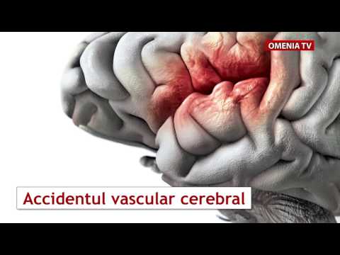 Afectarea vederii vasculare