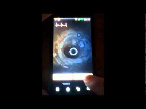 Nano Live Wallpaper Video