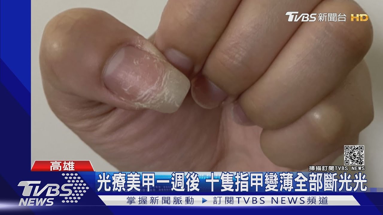 光療美甲一週後 十隻指甲變薄全部斷光光