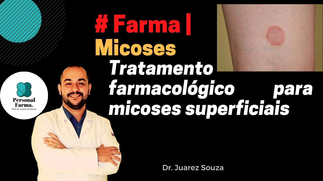 Farma | Tratamento Farmacológico de Dermatofitoses (Micoses Superficiais)