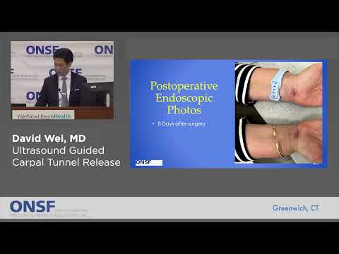 Dr. David Wei — Ultrasound Guided Carpal Tunnel Release lecture