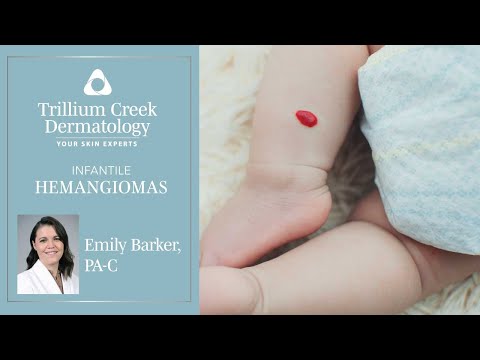 What are Infantile Hemangiomas?