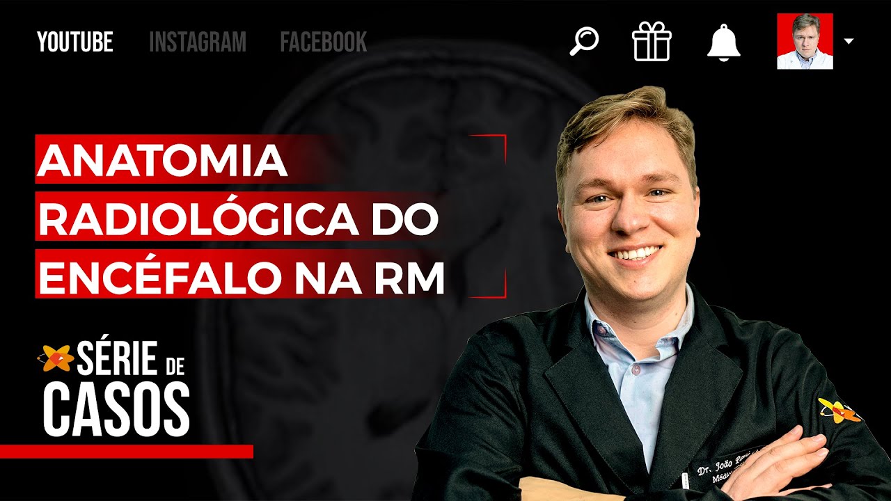 Anatomia Radiológica do Encéfalo na RM