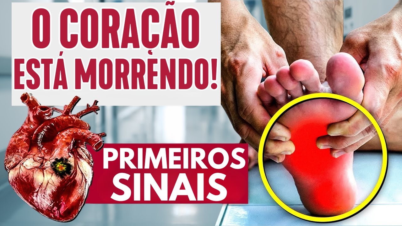 ESTES sintomas indicam que você tem vasos sanguíneos entupidos!