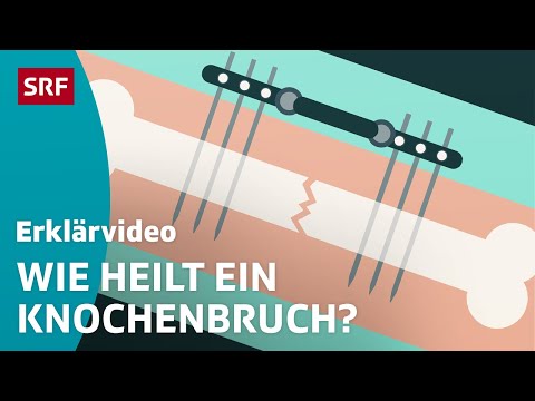 Knochen: Vom Aufbau zum Heilungsprozess – einfach erklärt | Kindervideos | SRF Kids