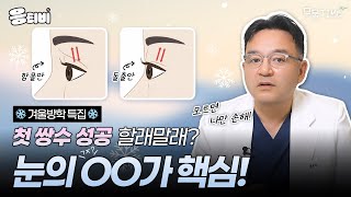 첫 쌍수 성공법, 눈의 구조가 핵심!👀｜눈성형｜윤현준 원장