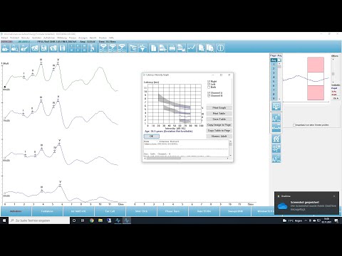 BERA - EP vs. ASSR einfach erklärt (Interview Video Podcast)