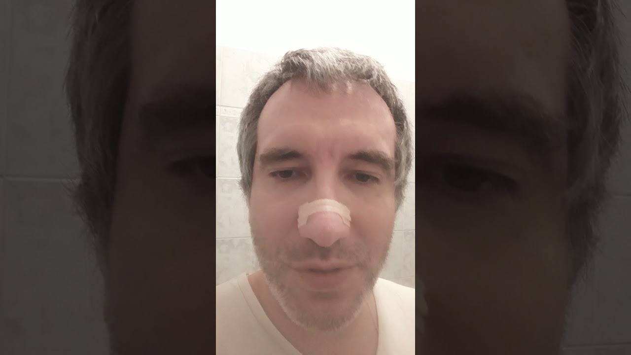 cerotto nasale antirussamento#shorts