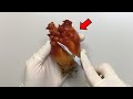 An Animal That Digests Its Brain Sea Squirt Dissection