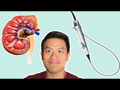 Choosing the right surgery for your kidney stone?