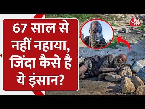 World's dirtiest man: सड़क पर मरे जानवरों को खाता है, 67 साल से नहीं नहाया ये शख्‍स!