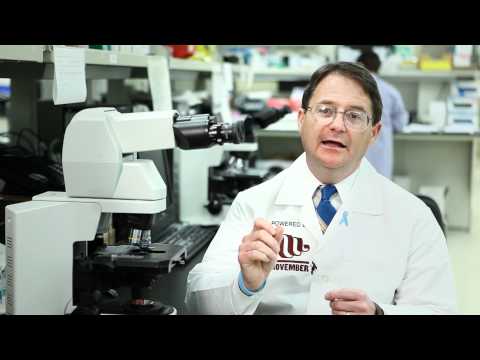 Movember is making an impact - PCF US Outcomes