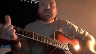 Motorhead: Listen To Your Heart (Acoustic Cover With Vocals)