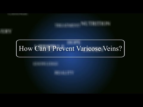 How Can I Prevent Varicose Veins