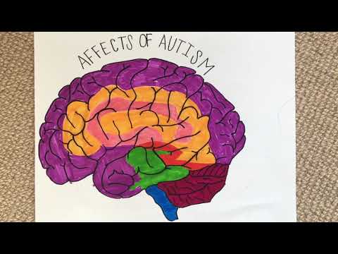 Autism on the brain by alex loos