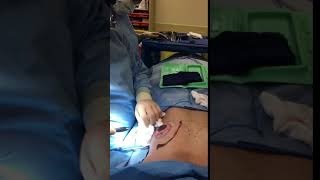 Dr. Reynolds - peri-areolar lift and breast augmentation Pt 2