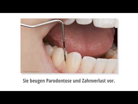 Professionelle Zahnreinigung (PZR) Kastellaun