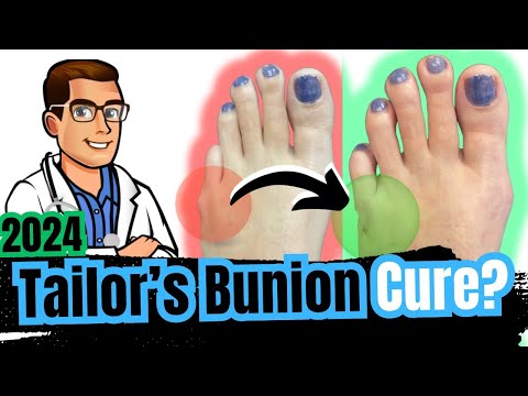 Bunion Home Treatment Top 7 Bunion Correctors Splints Gel Pads