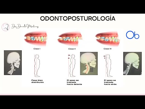 Postura corporal y oclusión dental