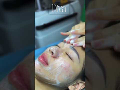 Melasma Treatment — Pico Laser at DIVA Skin Clinic Poipet