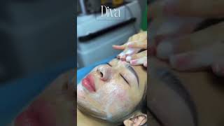 Melasma Treatment — Pico Laser