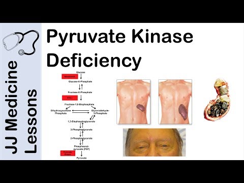 Acanthosis Nigricans Risks Pathogenesis and Treatments