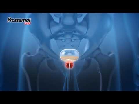 Wie Prostatitis in Astrachan zu behandeln Zäpfchen für die Behandlung von Prostatitis während Exazerbation
