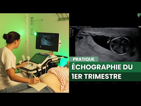 Échographie du 1er trimestre : Démonstration et Formation Pratique
