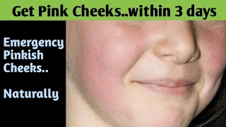 How to Get Rosy Pink Cheeks in 3 days | Get Pink Glowing Cheeks | Get Fair Pink Glowing Skin