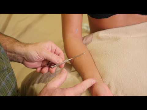 AcuPractice Videos: Lung meridian 7min 56sec