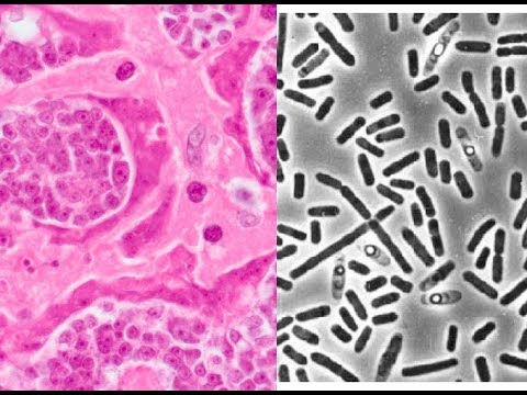 Gonococcus Trichomonas vaginalis szal