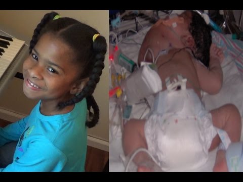 8 Year Old Girl with Cervical Teratoma Surprises Dad