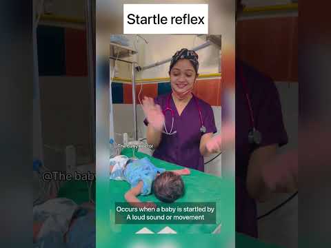 Startle reflex in newborn | moro’s reflex | baby doctor #newborn #babyvideos #shorts #cutebaby