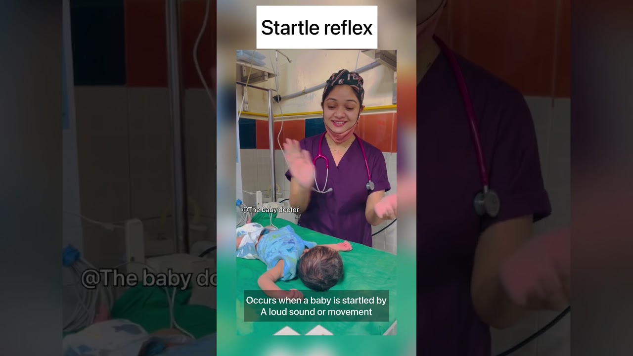 Startle reflex in newborn | moro’s reflex | baby doctor #newborn #babyvideos #shorts #cutebaby