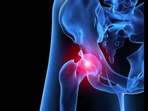 Schmerz im Arm an der Schultergelenkbehandlung Ein Arzt behandelt Osteochondrose der lumbosakralen Wirbelsäule