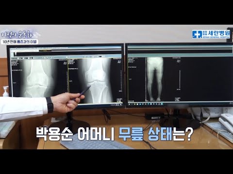 [기적의 운동화] 농사일로 닳아버린 무릎, 치료가 가능할까요?