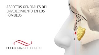 ¿Por qué envejecen los pómulos Soluciones