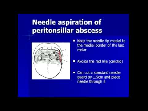 ENT and Ophthalmologic Emergencies (NURRC)