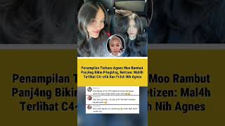 Download lagu Agnes' New Look Leaves Netizens Totally Stunned!! mp3 Download lagu Agnes' New Look Leaves Netizens Totally Stunned!! mp3