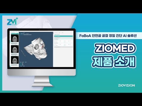 안면골 골절 진단 시스템 지오메드(ZioMED-FaBoA)